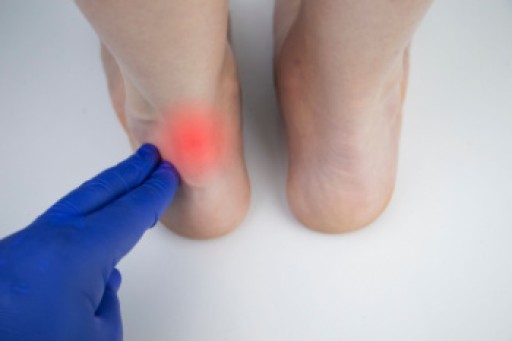 The Causes, Types, and Treatments of Achilles Tendon Injuries