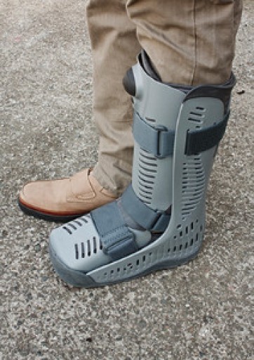 All About Broken Ankles
