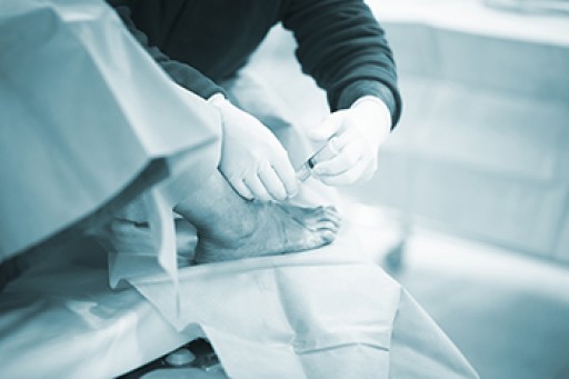 How to Care for Your Arthritic Foot