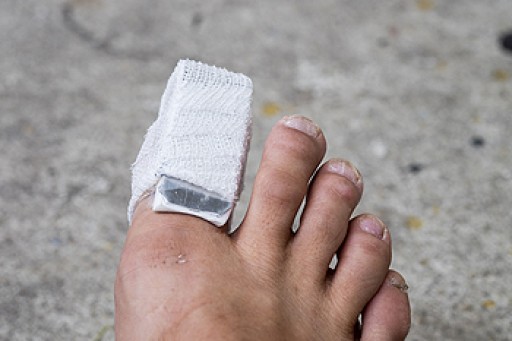 What to Know About a Broken Toe