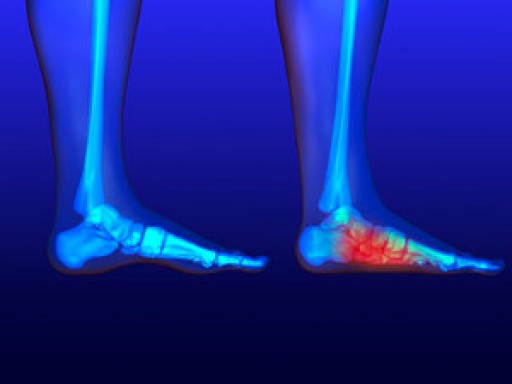 Flat Feet
