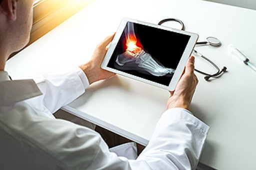 The Ankle Joint