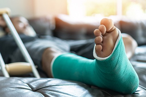 Did I Break My Foot?