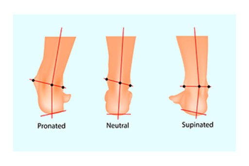 Biomechanics in Podiatry