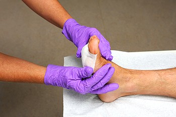 Foot Ulcers and Proper Wound Care