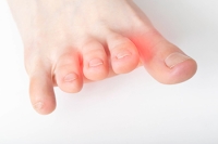 Relief Options for Mild and Severe Cases of Morton’s Neuroma